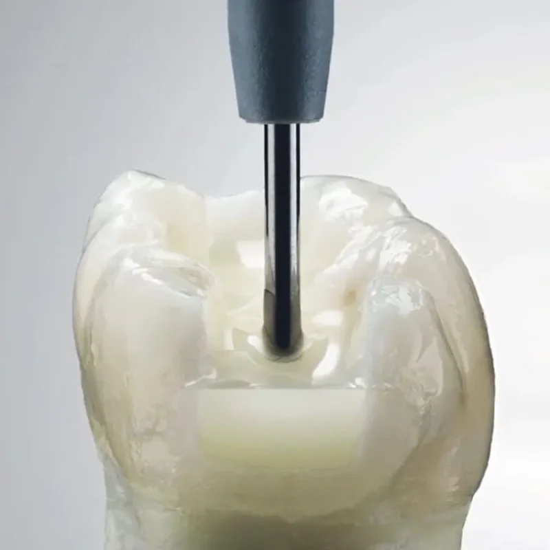 Dentsply SDR Plus Flowable Bulk Filling Material | Dental Product at Lowest Price