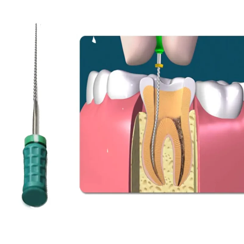 Dentsply M-Access K-Files 31mm (Hand Operated Files) | Dental Product at Lowest Price