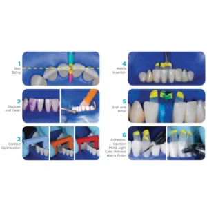 Bioclear TruContact Saw Kit