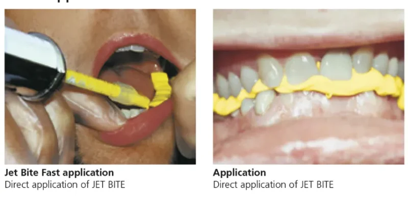 Coltene Jet Bite | Lowest Price